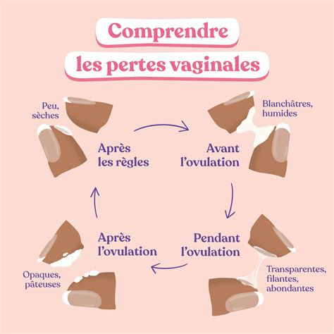 perte blanche infection|Leucorrhées : définition, symptômes et traitement